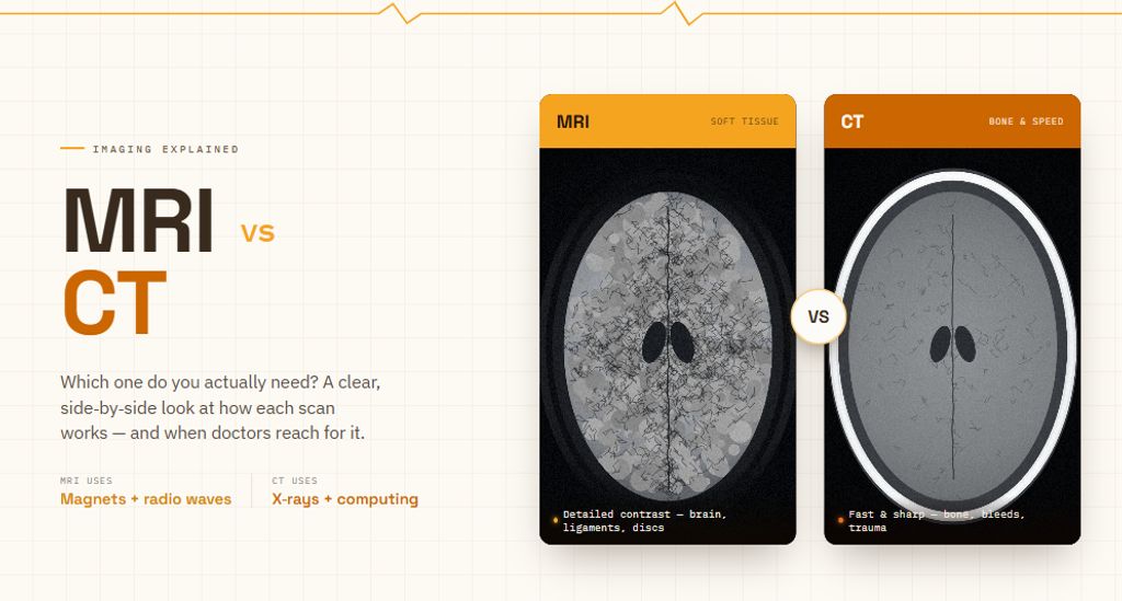 MRI vs CT Scan: Which One Do You Actually Need?